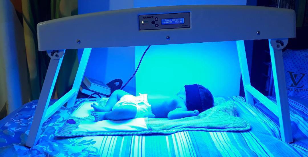 فتوتراپی LED چهار لامپ برند آنامد فتوتراپی LED شش لامپ برند آنامد