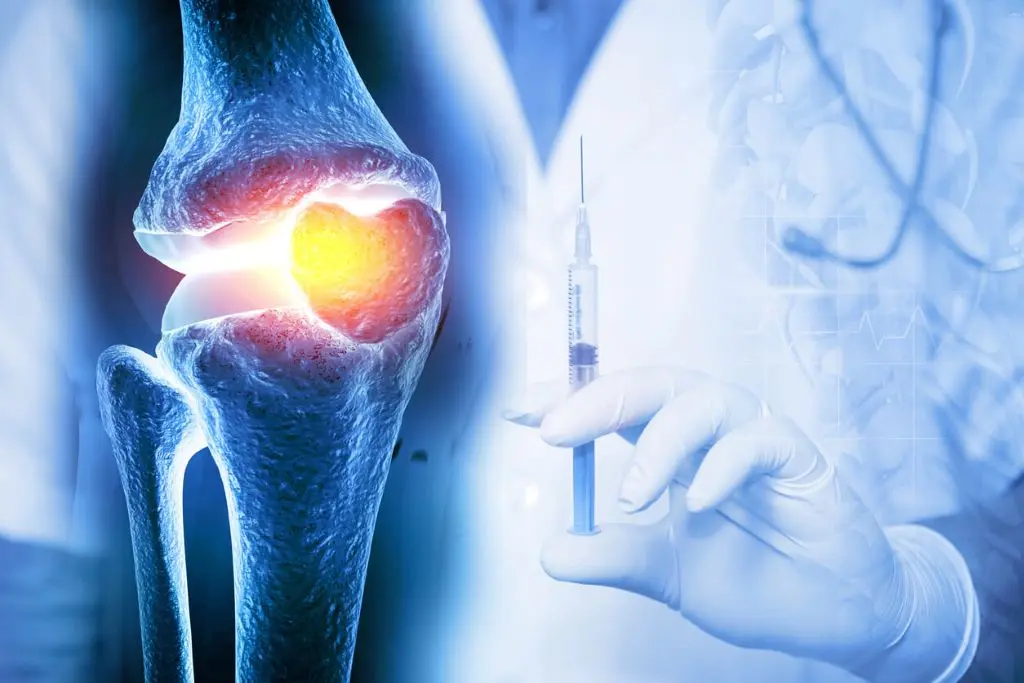 prp چیست-2-min prp چیست